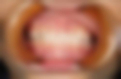 四川广安兴诚口腔擅长项目