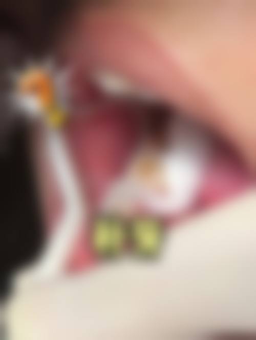 四川广安兴诚口腔电话号码