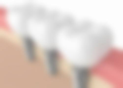 浙江舟山定海宏康口腔真实实例