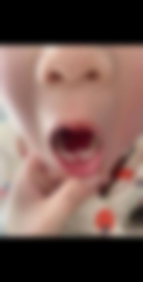 苏州蓝芽口腔诊所口碑怎么样：患者的真实评价