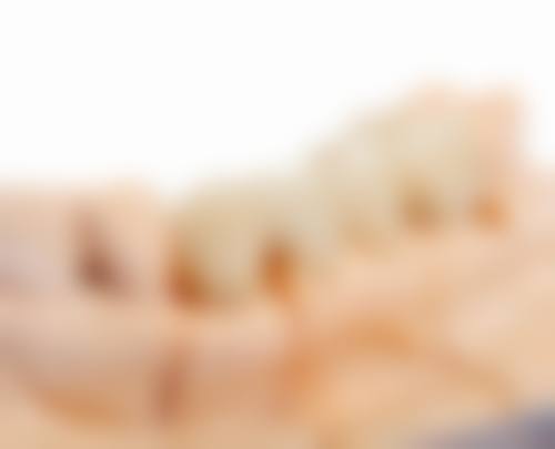 东莞李生口腔真实实例：见证口腔蜕变