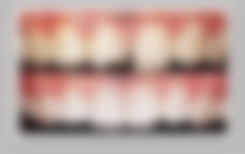拔牙后创口护理要注意什么