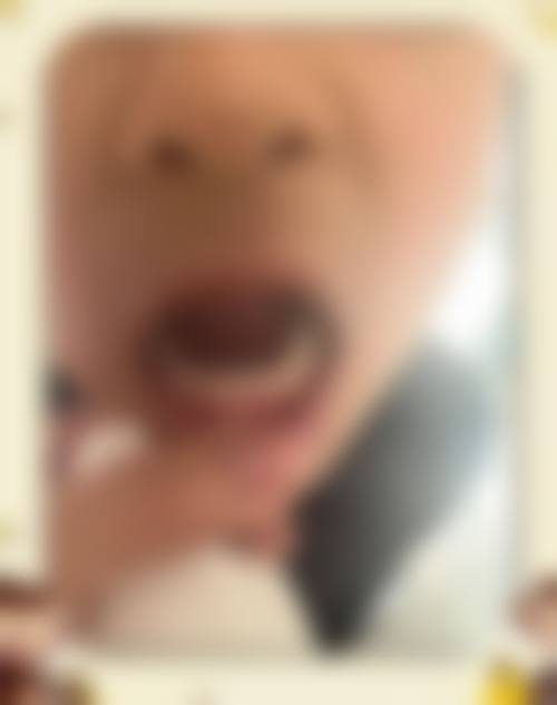 山东济南一牙口腔价格表