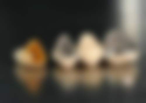 钴铬烤瓷牙与全瓷牙哪个更适合自己?