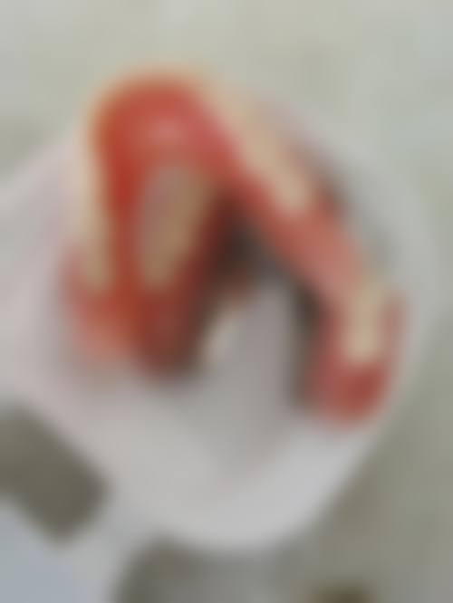 长沙齿诺口腔门诊部真实实例：见证神奇的改变