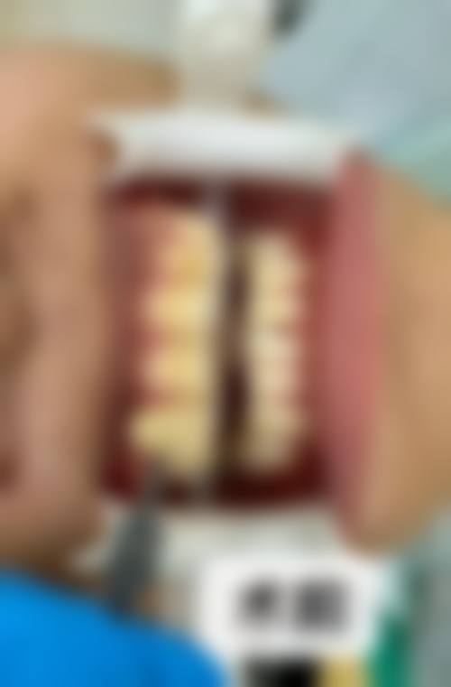 华容皇贝口腔门诊部擅长项目:满足多样口腔需求