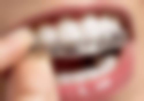 楚雄博洁口腔门诊部特色项目与服务流程详解
