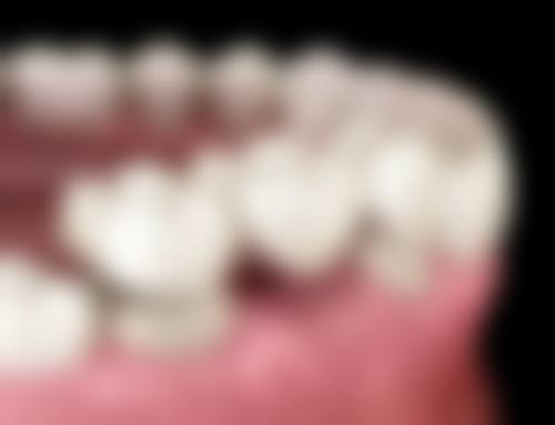 总结:为何沙赫拉姆.沙姆斯瓦利是您值得信赖的种植骨干医生