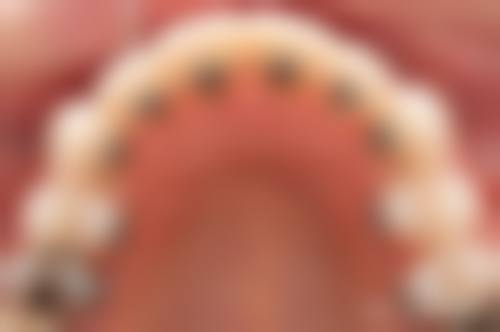 总结与展望