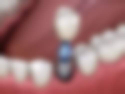 徐州睢宁牙百佳口腔门诊部