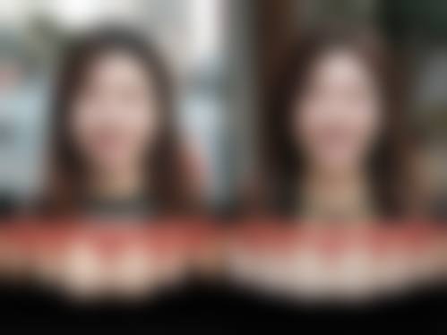包头昆都仑贝洁雅口腔门诊部用户口碑与真实实例分享