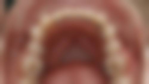 甘肃定西博鑫口腔牙齿矫正价格表及性价比分析