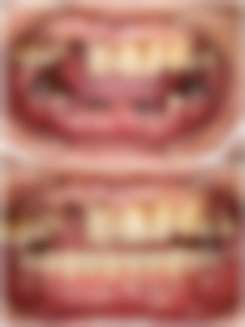 深圳诚美口腔门诊部热门项目深度评测与优势解读
