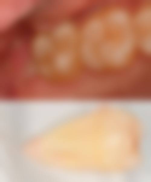 湖北十堰郧西县爱牙口腔价格体系与性价比分析